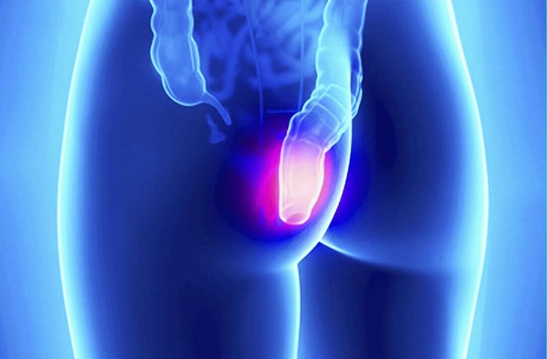 Gelarex se može koristiti i izvana i rektalno